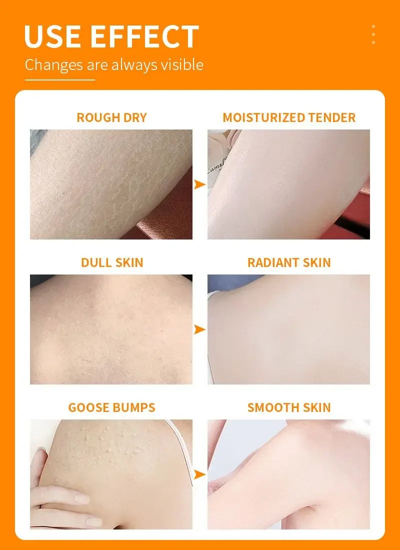 Vitamin C  Whitening Body Cream Moisturizing Lightening Body Lotion Intimate Dark Remove MelaninSkin Care Remove Chicken Skin
